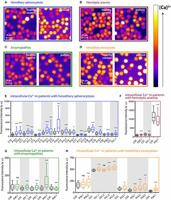 Is Increased Intracellular Calcium in Red Blood Cells a Common Component in the Molecular Mechanism Causing Anemia?